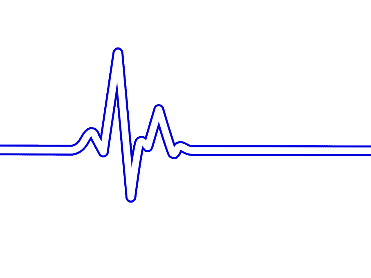 ¿Cuáles Son los BPM Promedio de los Géneros Musicales?