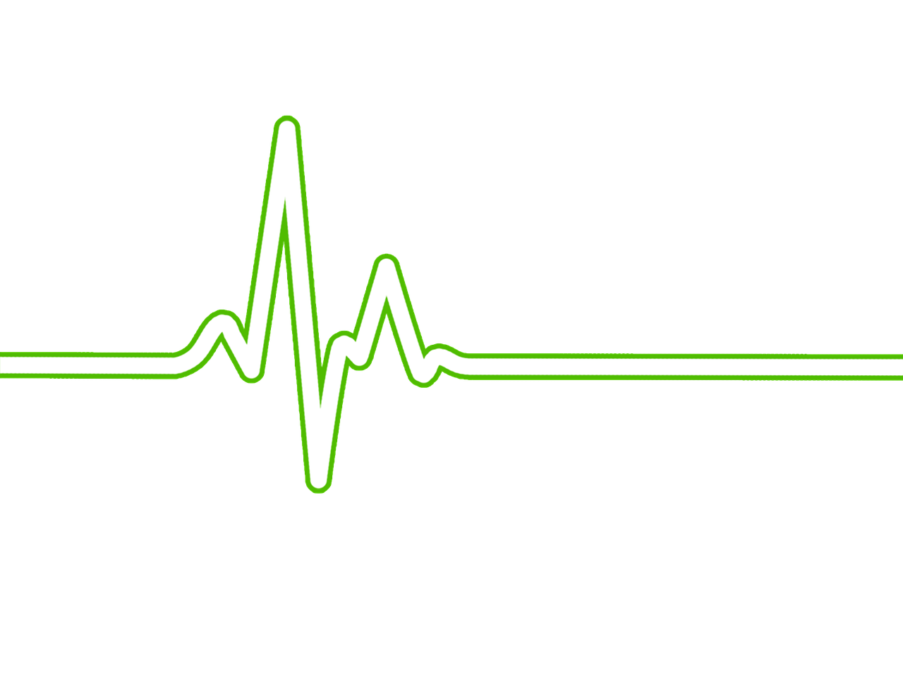 ¿Cómo funciona el BPM en audio?